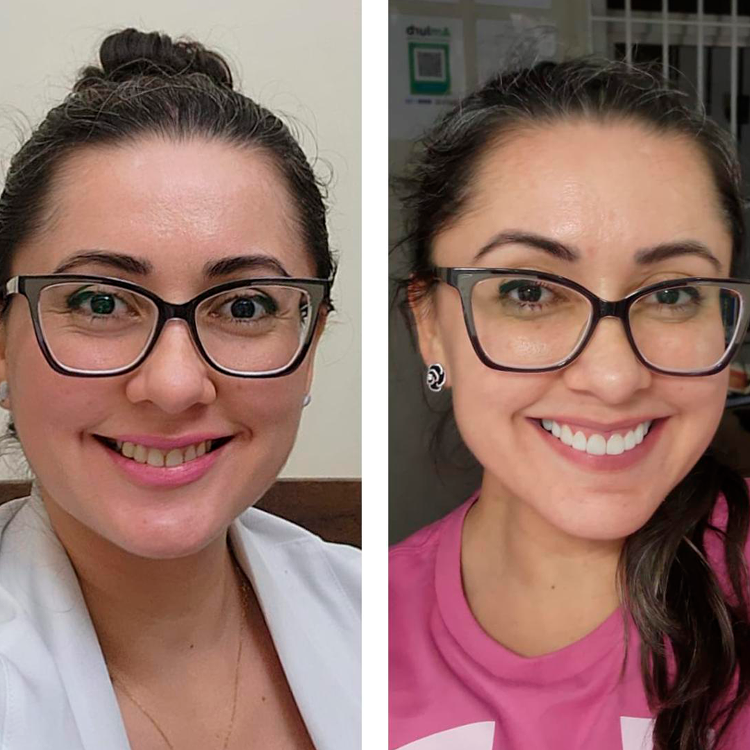 Antes e depois - Caso 1