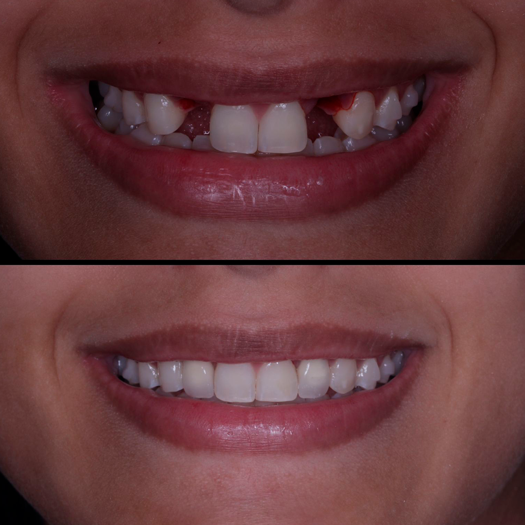 Antes e depois - Caso 3