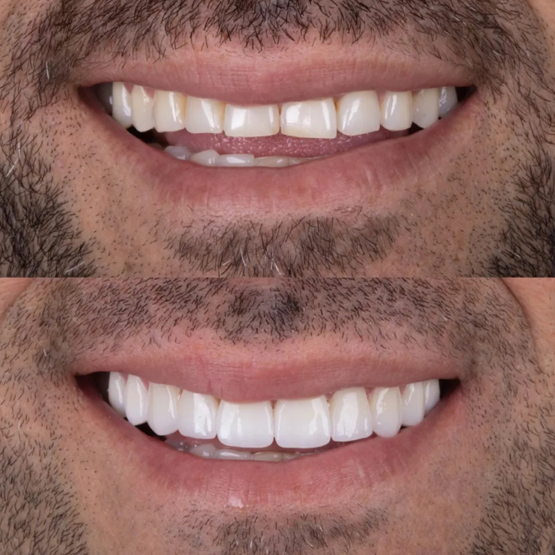 Antes e depois - Caso 5